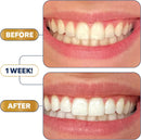 Lumineux Ultimate Whitening Kit Bundle - Contains Toothpaste, Mouthwash, Strips and Whitening Pen - Enamel Safe and Clinically Proven to Whiten Without The Sensitivity - Removes Coffee and Tea Stains Infinity Warehouse