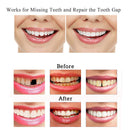Temporary Tooth Repair Kit-Thermal Beads for Filling Fix the Missing and Broken Tooth or Adhesive the Denture Fake Teeth Brige
