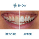 Snow Teeth Whitening Refill SNOW