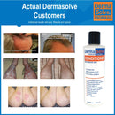 Scalp Psoriasis & Dandruff Shampoo and Conditioner by DermaSolve | Seborrheic Dermatitis Shampoo & Conditioner - Naturally Heals Itchy Flakey Inflamed Skin and Provides Soothing Moisturizing Relief Dermasolve