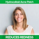 DR. ZAPS Pimple Patches - Acne Patches Work as Pimple Treatment - Hydrocolloid Patches Use Australian Tea Tree Oil. Acne Spot Treatment, Zit Patch, and Acne Patch for Everyone. Keppi