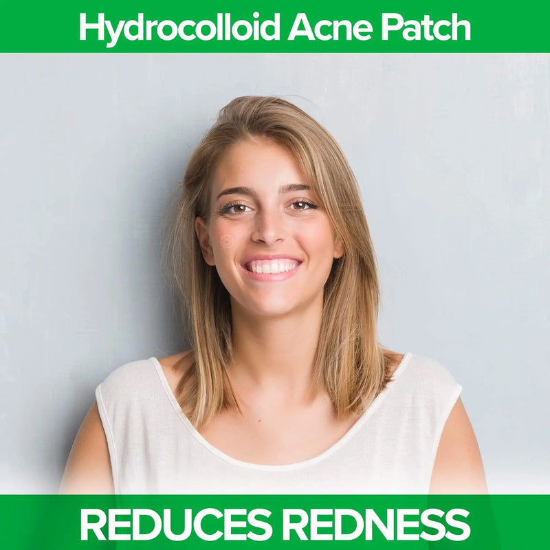 DR. ZAPS Pimple Patches - Acne Patches Work as Pimple Treatment - Hydrocolloid Patches Use Australian Tea Tree Oil. Acne Spot Treatment, Zit Patch, and Acne Patch for Everyone. Keppi