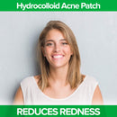 DR. ZAPS Pimple Patches - Acne Patches Work as Pimple Treatment - Hydrocolloid Patches Use Australian Tea Tree Oil. Acne Spot Treatment, Zit Patch, and Acne Patch for Everyone. Keppi