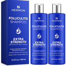 Hermon Folliculitis Shampoo for Itchy Scalp: Psoriasis, Dandruff & Seborrheic Dermatitis & Biotin – Soothes | Exfoliates | Reactivates Follicles Infinity Warehouse