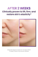 BIOHEAL BOH Probioderm 3D Lifting Skincare Set | Anti-Aging Face Moisturizer Night Cream, Ampoule & Facial Serum Spray | Korean Skin Care Kit for Firming & Hydration | K Beauty Gift Set for Women Infinity Warehouse