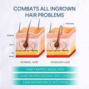 Evagloss Razor Bumps Solution- After Shave Repair Serum for Ingrown and Burns, Dark Spot Corrector Skin Lightening, Roll-On for Men and Women -100g Evagloss