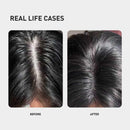 KINTOR 0.9% KX-826 DHT Blocker for Men & Women Hair Growth,Hair Growth Products Foam 60ml Pro Infinity Warehouse