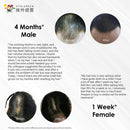 Vita Hair Growth & Hair Loss 100% Natural Herbs Potent Formula for Greying Thinning Hair Stimulate New Hair Follicles Supplement for Men/Women- 270 Capsules (90 Capsules x 3 Bottles) Vita Green