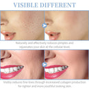 TUMAKOU Professional High Frequency Facial Machine - Face Skin Therapy Wand for Wrinkle Reducing, Skin Tightening, Anti Wrinkle, Dark Circles TUMAKOU