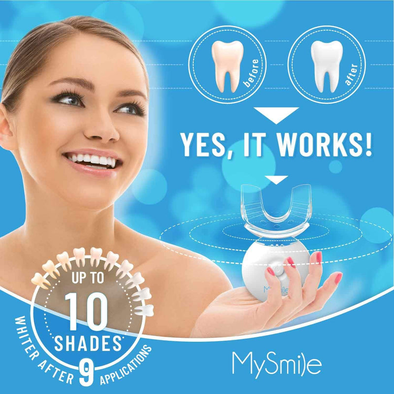 MySmile Teeth Whitening Kit with LED Light, 10 Min Non-Sensitive Fast Teeth Whitener with 3 Carbamide Peroxide Teeth Whitening Gel, Helps to Remove Stains from Coffee, Smoking, Wines, Soda, Food mysmile