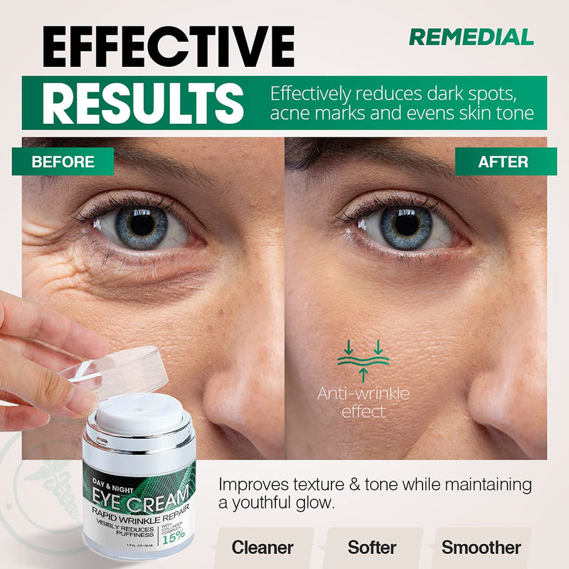 Eye Cream for Dark Circles Wrinkles Puffiness and Bags Under Eyes – Anti-Aging Collagen Eye Cream – Day and Night Formula with Caffeine, Dimethicone and Vitamin B – 1.7 Oz REMEDIAL