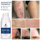 100% Silicone Scar Gel 2 Pack: 2 x 1.06oz Tubes for Surgical Scars, C-Section, Acne, Keloids, Burns, Stretch Marks – Advanced Scar Treatment for Old & New Scars Infinity Warehouse