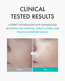 REJURAN® Turnover Mask, c-PDRN® (5ea) – Original Salmon DNA for Firming, Hydration, Repairing & Revitalizing. Achieve Youthful, Radiant Skin. Korean Skincare. Ultra Microfiber Sheet Mask Infinity Warehouse