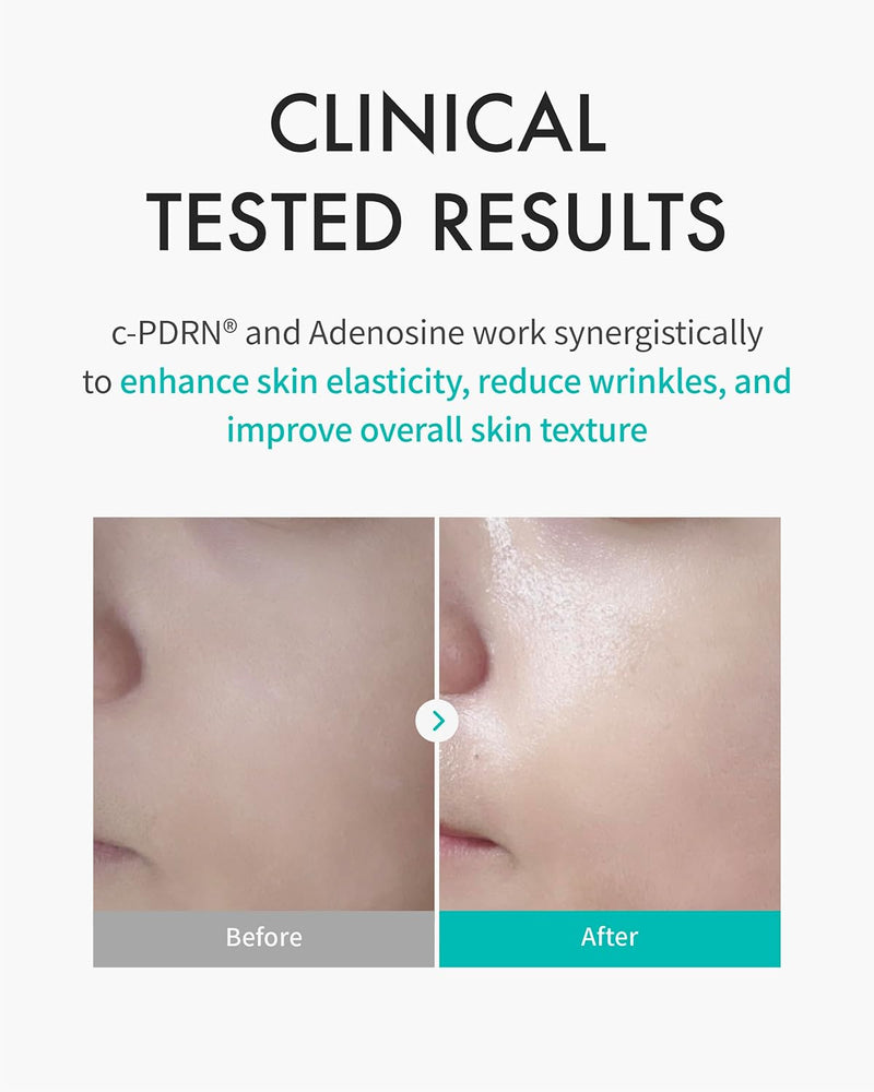 REJURAN® Turnover Mask, c-PDRN® (5ea) – Original Salmon DNA for Firming, Hydration, Repairing & Revitalizing. Achieve Youthful, Radiant Skin. Korean Skincare. Ultra Microfiber Sheet Mask Infinity Warehouse