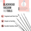 The Good Stuff Black Head Removal Tools with Mirrored Travel Case, 5 pcs Kit, Black The Good Stuff