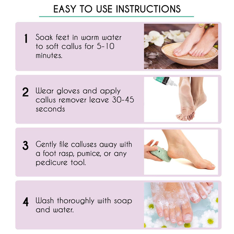 Professional Best Callus Remover Gel for Feet And Foot Pumice Stone Scrubber Kit Remove Hard Skins Heels and Tough Callouses from feet Quickly and Effortless 4 oz (2 Bottles) Karlash