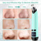 Blackhead Remover Pore Vacuum Cleaner, Facial Pore Cleaner Suctioner, Electric Acne Comedone Whitehead Extractor Tools Beauty Device for Women & Men SIHOHAN