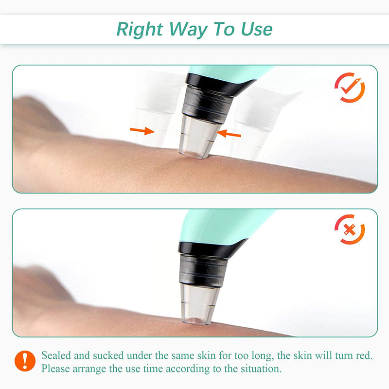 Blackhead Remover Pore Vacuum Cleaner, Facial Pore Cleaner Suctioner, Electric Acne Comedone Whitehead Extractor Tools Beauty Device for Women & Men SIHOHAN
