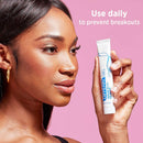 Acne Treatment Differin Gel, 30 Day Supply, Retinoid Treatment for Face with 0.1% Adapalene, Gentle Skin Care for Acne Prone Sensitive Skin, 15g Tube Differin