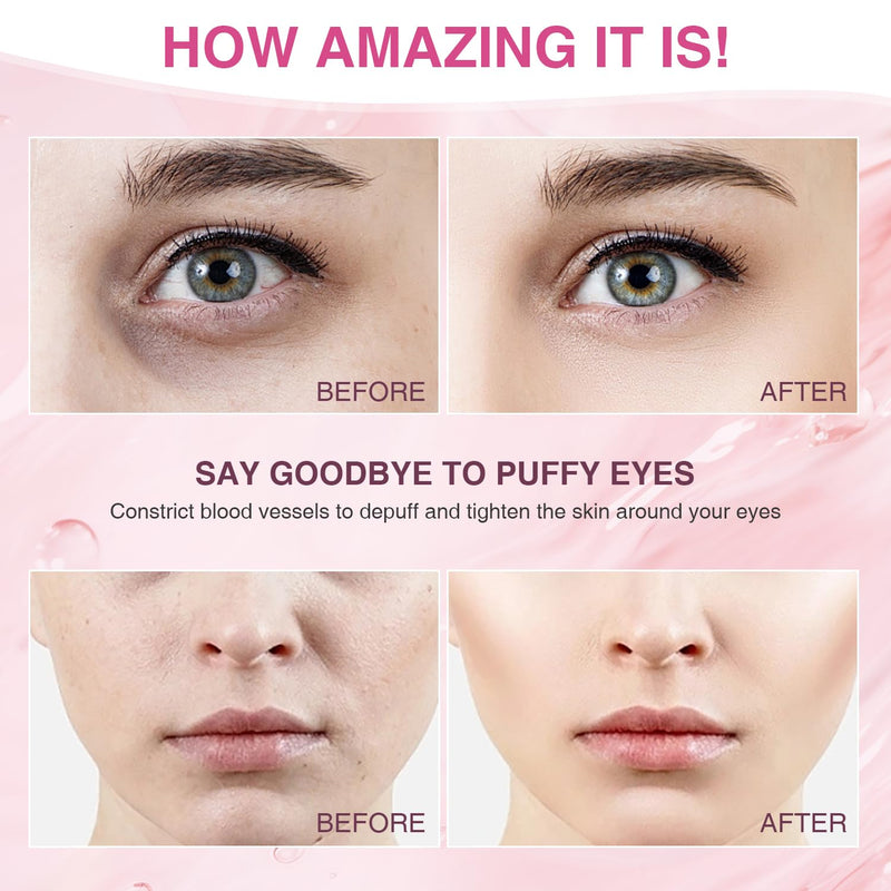 Facial Ice Roller for Skin Care - Aluminum Face Roller to De-Puff, Soothe & Tighten Pores - Cold Therapy Massage Tool for Radiant Glow Infinity Warehouse