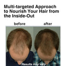 Dr. Steven Gabriel Natural DHT Blocker for Women and Men - Hair Growth Supplement with Saw Palmetto, Stinging Nettle, Pygeum Bark, Pumpkin Seed Oil Capsules (60 Caps) Infinity Warehouse