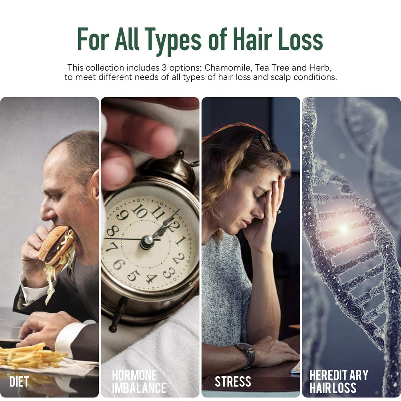 Hair Loss Treatment, LamFun Hair Growth Spray, 5% Minoxidil Topical Solution for Hair Loss, Shinning and Balding, Professional Hair Regrowth Treatment for Men & Women, No Alcohol and Non-oily (100ML) LamFun