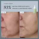 Alpha-H Face Serum - Daily Brightening For Dull, Uneven Complexion - Helps Boost Glow And Smooth Texture - Lightweight Comfort For Dry, Sensitive Skin Infinity Warehouse