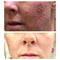 Glycolic Acid 40% (Professional Chemical Peel) Pro Strength Alpha Hydroxy Acid Skin Peel - Intense Anti-Aging Treatment For Wrinkles, Fine Lines, Brown Spots, and Acne Scarring - Beauty Coquette