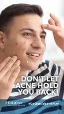 De La Cruz 10% Sulfur Ointment Acne Treatment - Medication to Clear Cystic Acne Pimples and Blackheads on Face and Body - Made in USA - Jumbo Size 5.5 oz De La Cruz