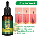 Ginger Germinal Oil, Ginger Hair Growth Serum, Ginger Essential Oil Stop Hair Loss Hair, Thinning Treatment Hair Growth Oil for Women & Men 30ML(3Pack) Lericttor