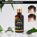 Hair Growth Oil Natural with Caffeine, Biotin and Castor - Hair Growth Oil for Stronger, Thicker, Longer Hair 1.7 oz VigorWell