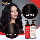 DHT Blocker Shampoo and Conditioner for Hair Loss With Biotin For Men, Women, Anti-Hair Loss Treatment, Rosemary Leaf Oil and Asparagus Extracts, for Thinning Hair (Shampoo and Conditioner) Infinity Warehouse