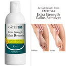 Cacee Callus Remover for Feet 8oz, Gel Formula with Tea Tree Oil & Lemon Scent, Works Great with Foot Scrubber, Foot File, or Pumice Stone, Callous or Corn Remover Cacee
