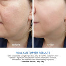 UltraHydrating Serum 3% Hyaluronic Acid Smoother Skin|Pre-makeup SkinCare|Anti-Aging serum for face Single-Use Vials Skincare|Hyaluronic Acid Tubes for Sensitive skin|4D Hyaluronic Acid(1.2 ml)*30 Infinity Warehouse