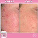 Glycolic Acid Resurfacing Pads with Vitamin B5, C & E, Green Tea, Calendula, Allantoin - Exfoliate Surface Skin, Minimize Pores and Reduce Fine Lines and Wrinkles - AHA Peel Pads Divine Derriere