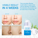 Sualsoce Dark Spot Corrector Serum, Dark Spot Remover with 4-Butylresorcinol, for Face and Body, Age Spots Sun Spots Corrector, All Skin Types 1 fl oz Sualsoce
