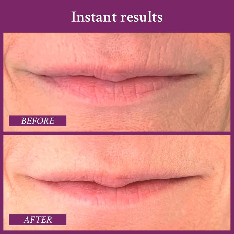 PRAI Beauty Ageless Lip and Line Filler for Instantly Ageless Lips | Lip Serum that Plumps, Smooths, & Fills In Lines | Moisturizing Lip and Line Filler with Vitamins C & E to Boost Collagen Infinity Warehouse