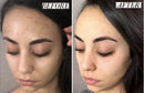 Dark Spot Corrector for Face. Skin Whitening Dark Spots Remover Cream, Use for Age Spots on Face Body Hands 4 OZ Active Bamboo