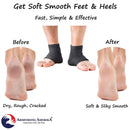 Moisturizing Socks for Mens Cracked Heels - Moisturizer Heel Sleeves to Smooth & Soften Rough Cracked Heels & Dry Feet. Large Aloe Moisturizing Heel Socks with Lotion Infused Gel Socks (XL - 3 Pairs) ARMSTRONG AMERIKA