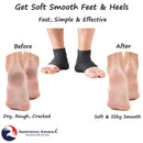 Moisturizing Socks for Mens Cracked Heels - Moisturizer Heel Sleeves to Smooth & Soften Rough Cracked Heels & Dry Feet. Large Aloe Moisturizing Heel Socks with Lotion Infused Gel Socks (XL - 3 Pairs) ARMSTRONG AMERIKA