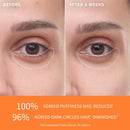 Sulwhasoo First Care Activating Eye Serum | Target Dark Circles & Fine Lines | Cooling Technology | Caffeine & Vitamin C | Korean Under Eye Treatment Infinity Warehouse