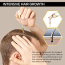 Hair Growth Oil Natural with Caffeine, Biotin and Castor - Hair Growth Oil for Stronger, Thicker, Longer Hair 1.7 oz VigorWell