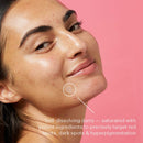 Peach Slices Dark Spot Micro Darts | For Dark Spots, Post-Blemish Redness, & Hyperpigmentation | Self-Dissolving | Niacinamide, Vitamin C, Hyaluronic Acid, and Cica | Vegan/Cruelty Free | 9 Patches Peach Slices