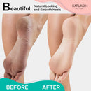 Karlash Professional Pedicure Foot Pumice Stone for Feet Skin Callus Remover and Scrubber for Dead Skins 2 Sided (Pack of 12) Karlash