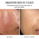 HERBIVORE Nova 15% Vitamin C + Turmeric Brightening Serum for Dark Spots, Hyperpigmentation + Even Skin Tone | Vegan, Plant-Based, Cruelty-Free, 30 mL / 1 oz Infinity Warehouse