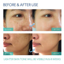 Evagloss Razor Bumps Solution- After Shave Repair Serum for Ingrown and Burns, Dark Spot Corrector Skin Lightening, Roll-On for Men and Women -100g Evagloss