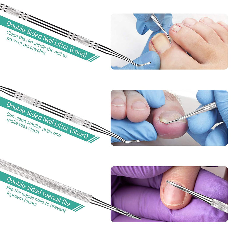 3-Pack Ingrown Toenail File And Lifters, 100% Professional Surgical Stainless Steel Ingrown Toenail Tool -Safe Nail Cleaning Treatment Pedicure Tools Kit Under Sidewall Cleaner Pain Relief Accessories POLKASTORE