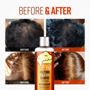 CRAZY SKIN Beers Shampoo - BIOTIN shampoo for hair loss, Rich with Beer Yeast for Hair Regrowth and Thickening, thinning hair, Sulfate free,10.15 fl oz(300g) X 2 Bottles CRAZY SKIN