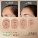 Hair Serum for Hair Growth Serum Women Made in USA - 3 Pack Scalp Serum for Hair Growth Non-Greasy Rosemary & Amla Hair Care Vegan 1 Oz Hair Loss Treatment for Women Regrowth Treatment Infinity Warehouse