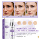 HANYWIL Dark Spot Remover for Face & Body Serum,Rapid Tone Repair Cream with Hyperpigmentation Treatment,Sun Spot, Age Spot & Melasma Remover,Dermatologist-Tested Brightening Retinol Serum (1.7 Fl Oz) Infinity Warehouse